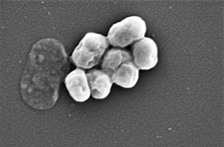 A Covid eltörpül ahhoz a pusztításhoz képest, amit az antibiotikumra rezisztens baktériumok okoznak majd
