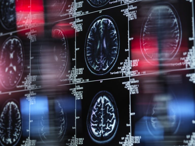 Minden eddiginél precízebb önkifejezést tesz lehetővé egy új agy-számítógép interfész technológia