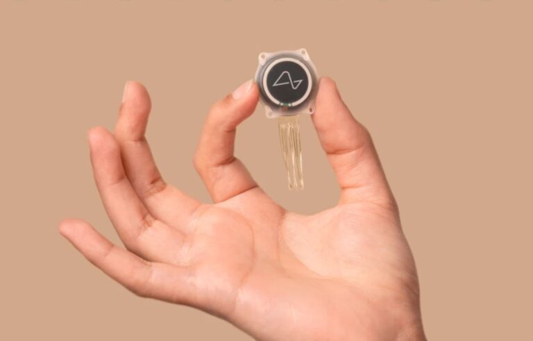Először ültetett be chipet egy ember agyába Elon Musk cége, a Neuralink