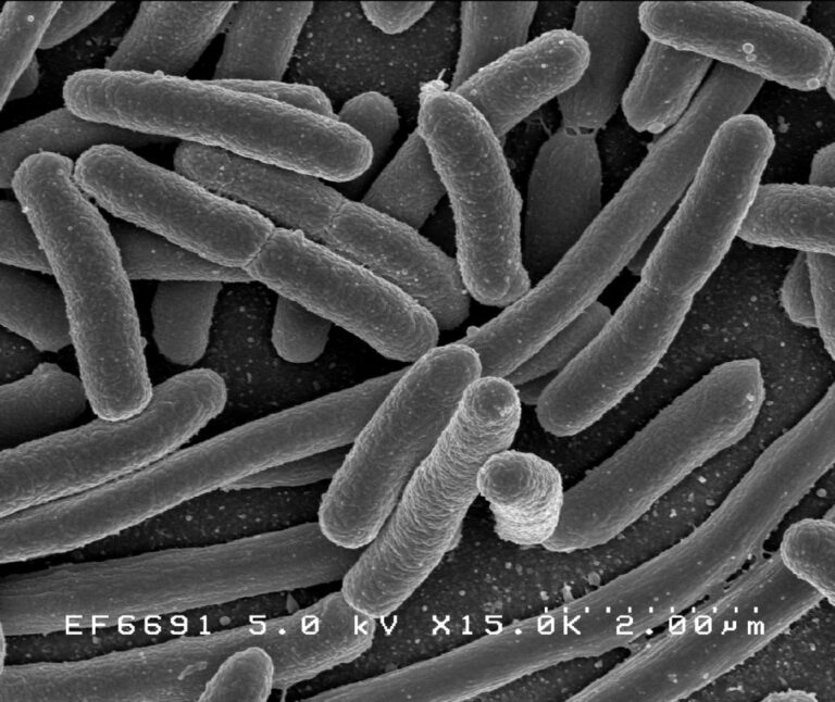 Egyszerű kísérlet szemlélteti, miért nem érnek semmit a legújabb antibiotikumok sem idővel