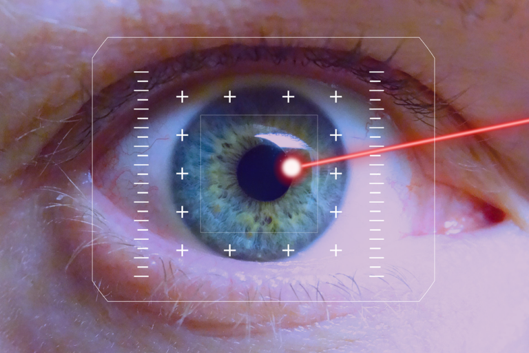 Leáldozhat az ellentmondásos LASIK technológiának - egy forradalmi módszer invazív műtét nélkül hozza rendbe a látást